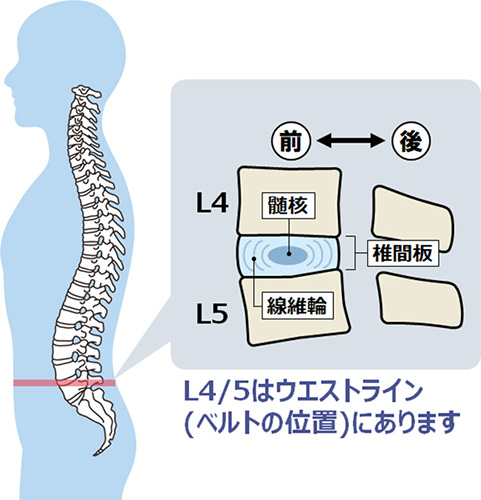 腰痛借金にハリ胸エクサ ゆきちゃんのブログ