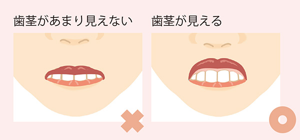 ほうれい線チェック