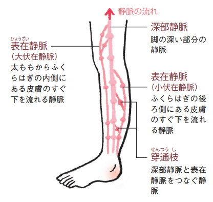 脚の主な静脈 下肢静脈瘤は皮膚のすぐ下を流れる2つの表在静脈に起こり、深部静脈には起こりません。