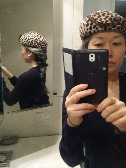 移行期も帽子やヘアアレンジでオシャレを楽みました(山中さん提供)