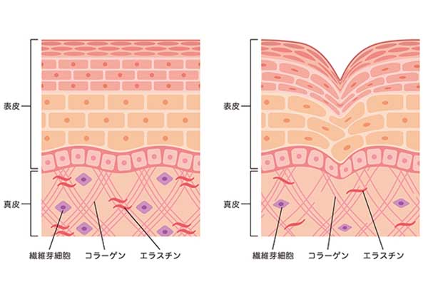 皮膚イメージ